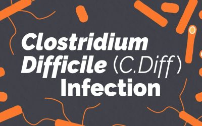 С.difficile-ассоциированная инфекция: ключевые моменты для пациентов