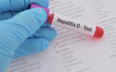 Образовательный модуль Medscape “Гепатит Дельта: диагностика пациентов”